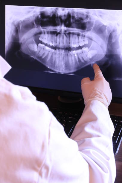 Best Emergency Dental Care for Broken or Chipped Teeth in Cedar Knolls, NJ